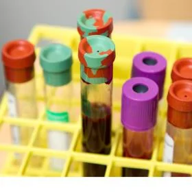 Vacutainers